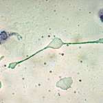 photo de cellule macrophage
